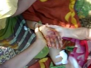 Burma Army Wounds 11-year-old Girl, Kills Man, Wounds Five Others in Continued Attacks, With 24,000 Now Displaced in Northern Karen State