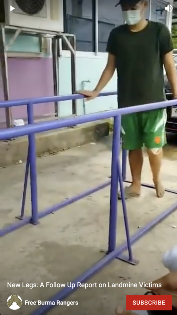 Video: Jue Aung walking on his new leg. 