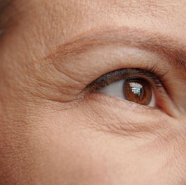 Understanding Skin Changes at 30 and the Impact of Collagen Loss