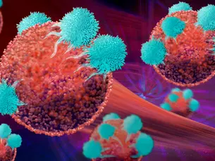 O cancro como verdadeiro teste de esforço do sistema de saúde @ Diário de Notícias