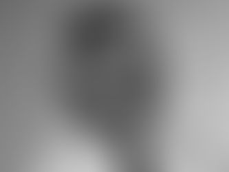 Alles was Du über Abszesse und Fisteln wissen musst! (mit Dr. med. Peter Ambe)