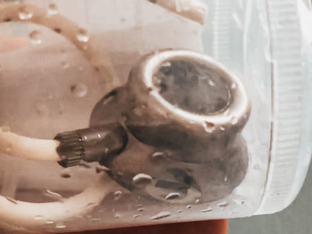 Alles über einen Portkatheter bei Morbus Crohn