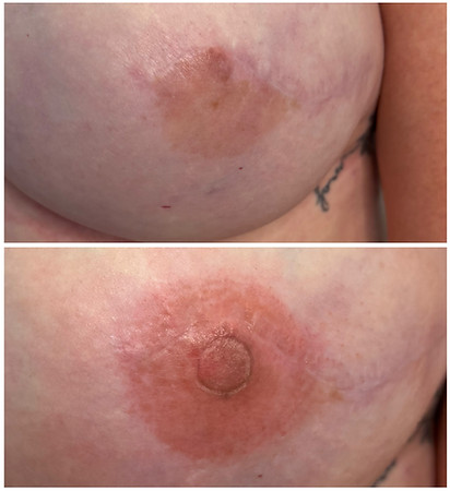 Nipple Tattoo Brisbane.JPG