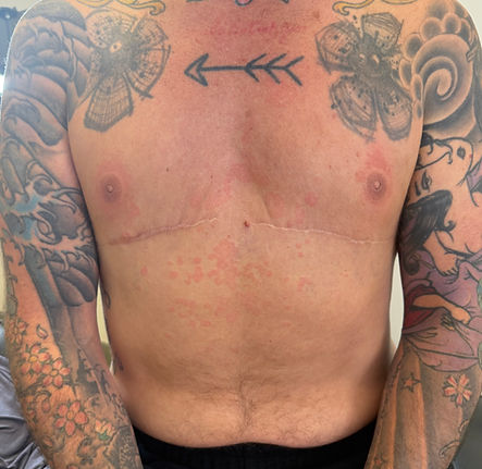 FTM Trans Nipple Tattoo.jpeg