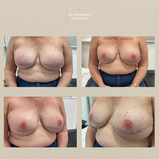 Best Nipple Tattoo Brisbane