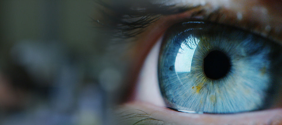 Close-up of an eyeball highlighting details for glaucoma surgery