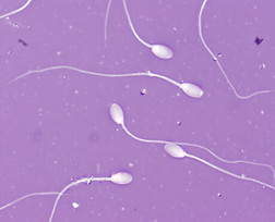 reproductin équin cheval collecte étalon