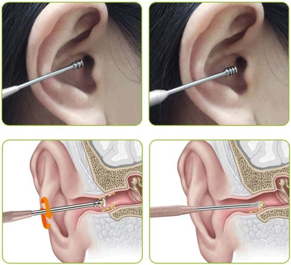 Ultimate Ear Care Kit: Earplugs, Wax Removal Tools, and Storage Bucket