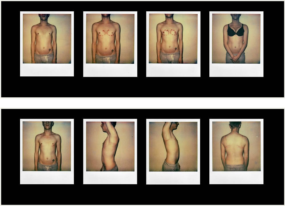 'How to create artificial breast'