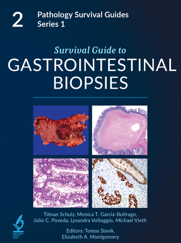 Survival Guide to Thoracic Pathology【新品】 Survival Guide To Thoracic Pathology – Enea Brivio