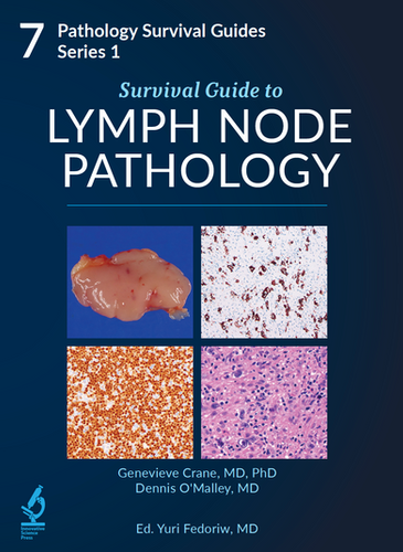 Survival Guide to Thoracic Pathology【新品】 Survival Guide to Thoracic Pathology: Sanjay Mukhopadhyay