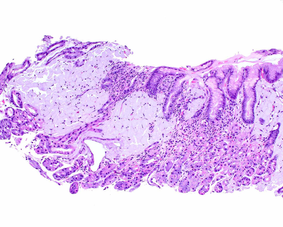 Case of the Week