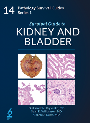 Survival Guide to Thoracic Pathology【新品】 Survival Guide to Kidney and Bladder | Innovative Pathology