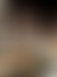 What to Eat on the Low Histamine Diet 