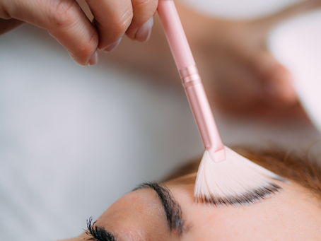 Top 5 Benefits of Regular Chemical Peels for Glowing Skin