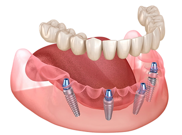 image-Photoroom (2).png