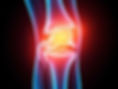 inflamed-joint.jpg
