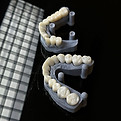 Models of full mouth restorations