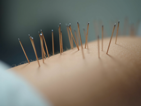 Explore Acupuncture Clinic Benefits at Yitcm
