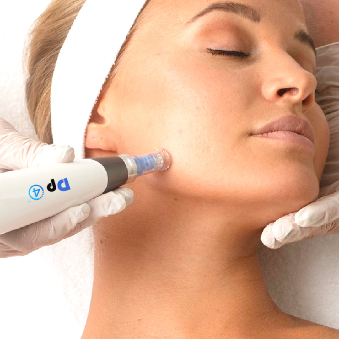 DP4 Microneedling Face & Neck Calgary