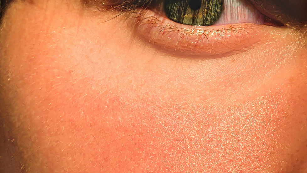 The 3 Most Common Skin Conditions and How to Treat Them