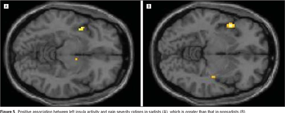 https://www.google.com/url?sa=i&url=https%3A%2F%2Fwww.semanticscholar.org%2Fpaper%2FIncreased-frontotemporal-activation-during-pain-in-Harenski-Thornton%2F89395ef6d660943b5fd04ca7e9a47a4ba749d48f&psig=AOvVaw0lXC8y6Dx5CY6Km_rOOLap&ust=1763671126500000&source=images&cd=vfe&opi=89978449&ved=0CBUQjRxqFwoTCPis5J2J_5ADFQAAAAAdAAAAABAx