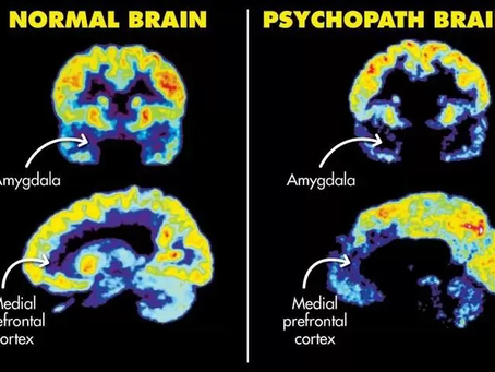The Pathology of Sadism