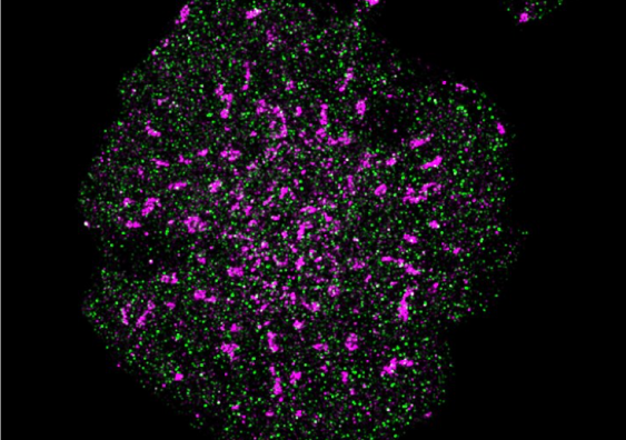 A T cell with precise localisation of T cell receptors (pink) and CD45 phosphatase (green). @ Single Molecule Science
