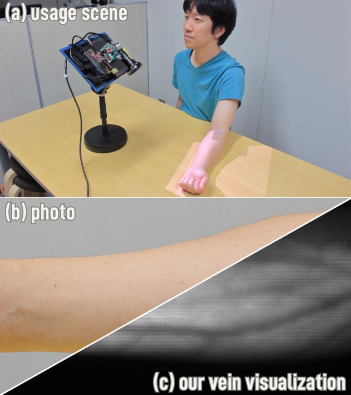Overview of the method. Usage scene of the device to capture the vein in the skin of the arm (a) and comparison between a photo (b) and the method (c). @ Hiroyuki Kubo