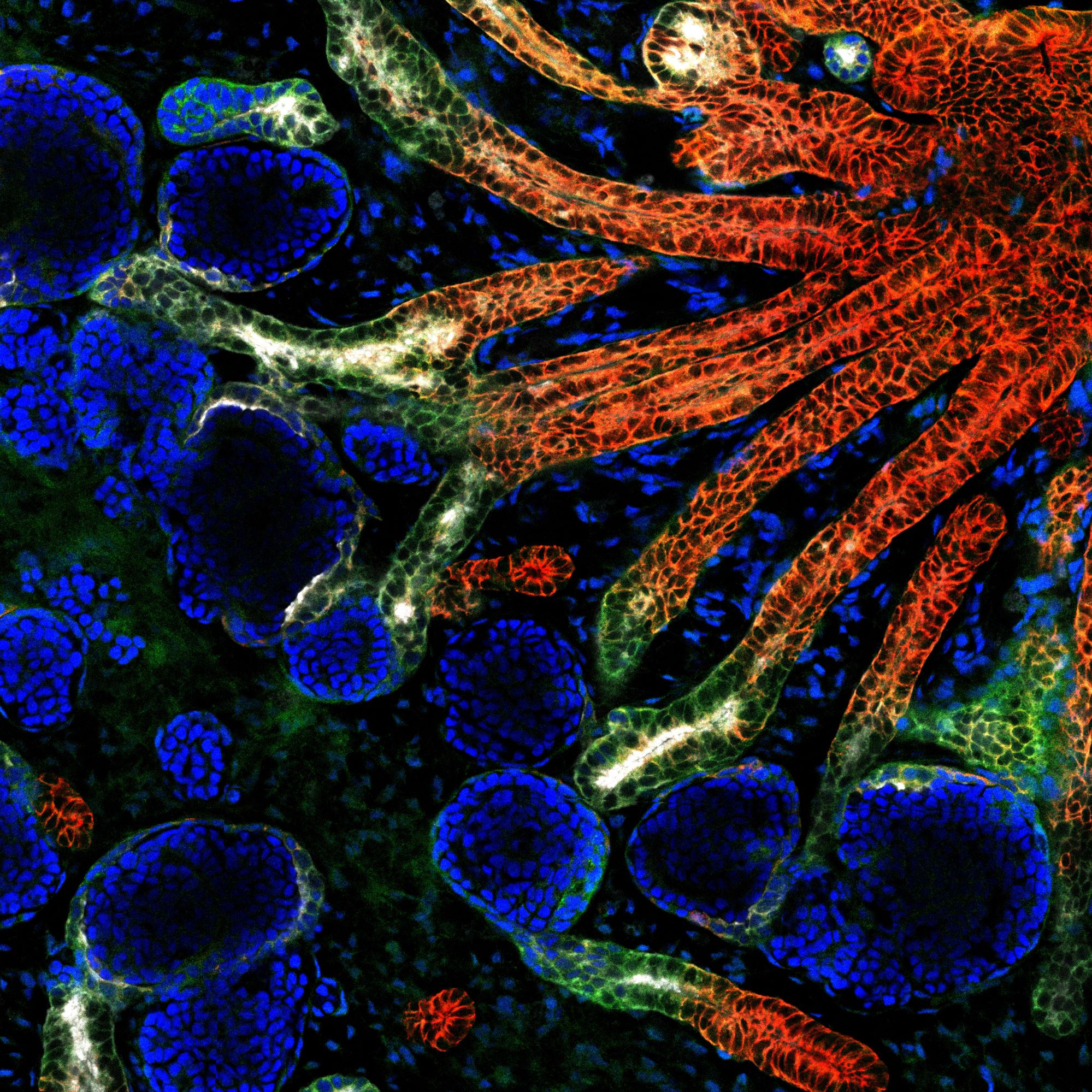 An image of a kidney organoid at Day 24 under confocal microscopy, which shows the preliminary development of structures in a kidney. @ NTU