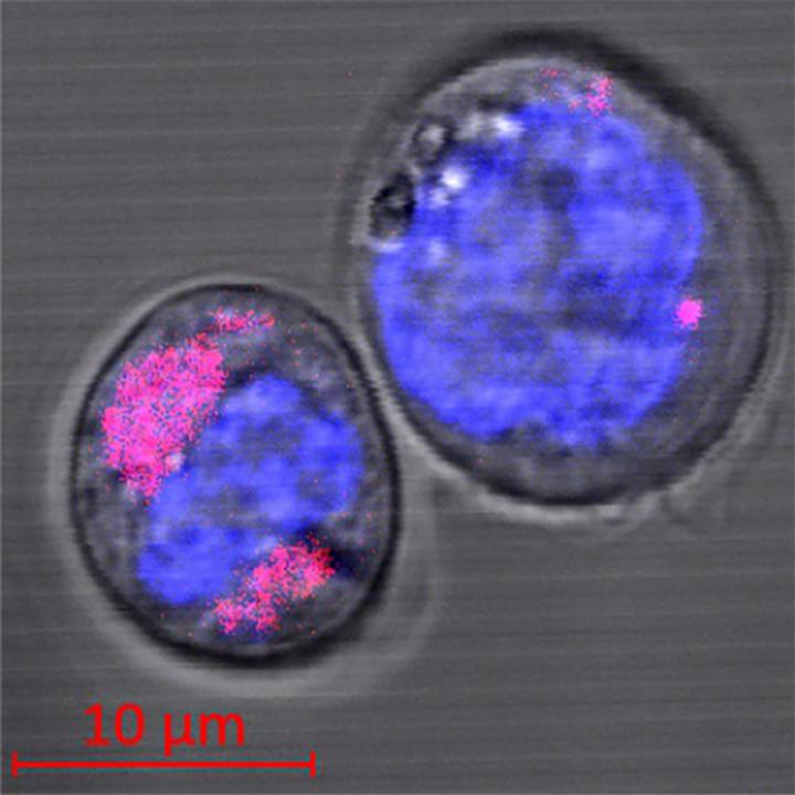 Two CD34+ stem cells containing carbon nanoparticles (coloured magenta); the cell nuclei can be seen in blue. The researchers found that the nanoparticles are encapsulated in the cell lysosomes. @ HHU / Stefan Fasbender