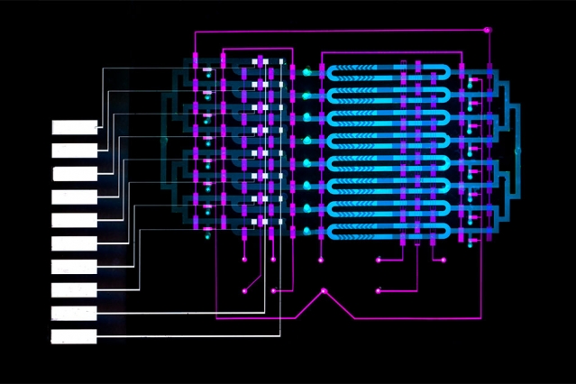 An MIT-invented microfluidics device could help doctors diagnose sepsis, a leading cause of death in U.S. hospitals, by automatically detecting elevated levels of a sepsis biomarker in about 25 minutes, using less than a finger prick of blood. @MIT, Felice Frankel