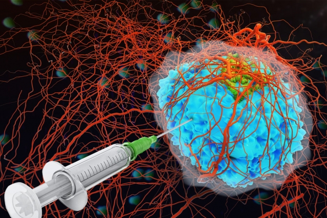A new technique prevents cell-killing proteins called cytokines from escaping once they have been injected into a tumor. @ MIT News