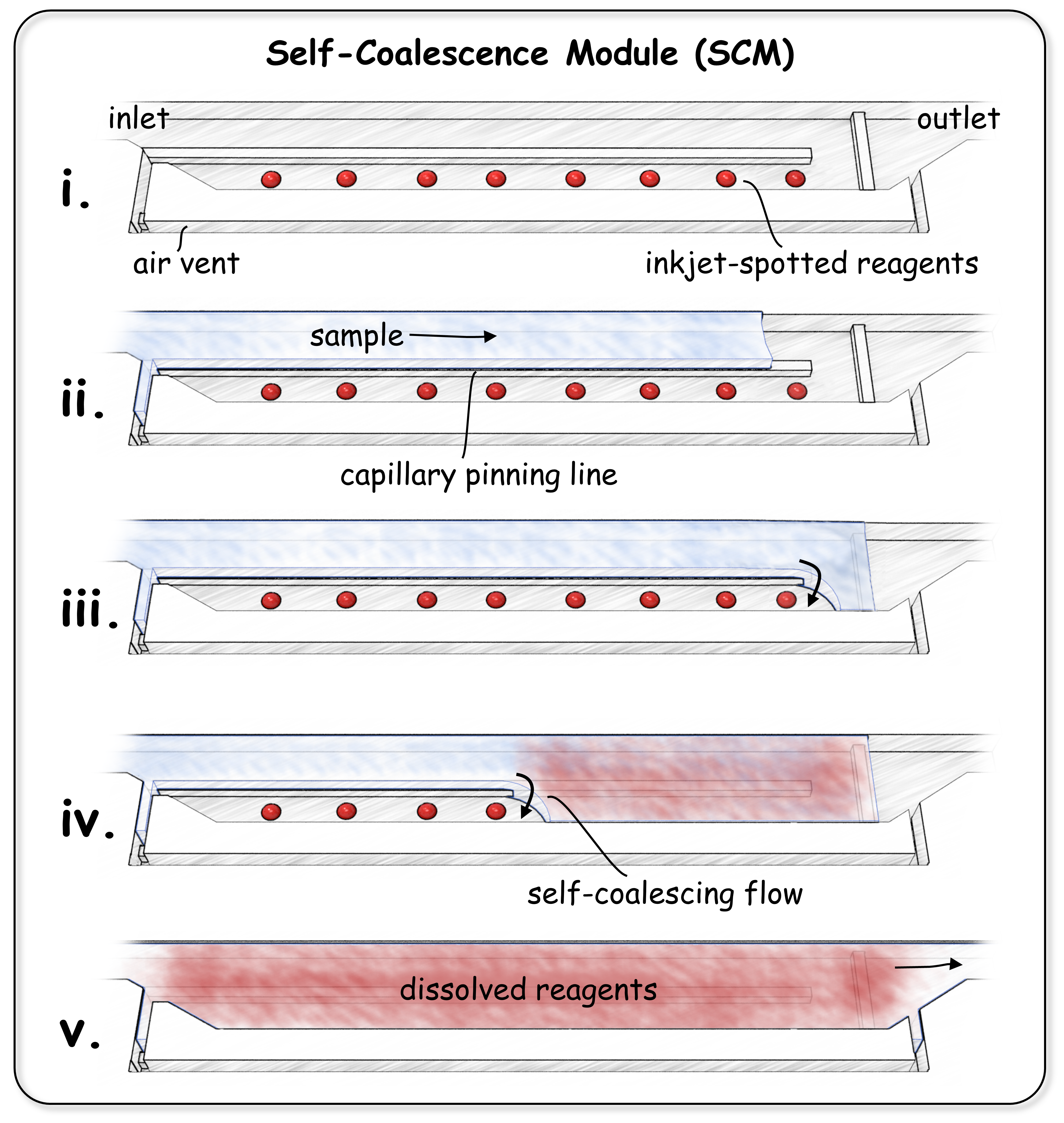 Artist's depiction of the process of self-coalescence in a microchannel. i) Picolitre-sized droplets of reagents are deposited by a process analogous to ink-jet printing into a microstructure, which is then sealed to form a microchannel a few tens of microns deep. ii) When the fluid sample is introduced, an air/water interface is created above the capillary pinning line at the middle of the channel. iii) The fluid is forced to make a U-turn and touch its own air/water interface, iv) causing it to "zip" along the interface, filling the channel perpendicularly to the general direction of the flow. v) In doing so, the reagents are reconstituted "on the spot" with minimal dispersion. @ Polytechnique Montreal and IBM Research Zurich