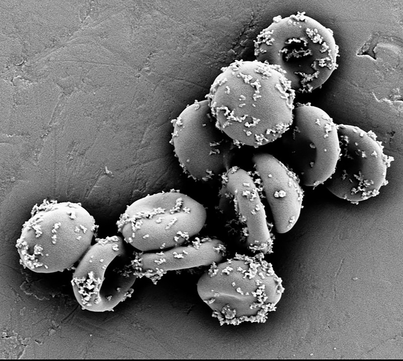 Tiny ELeCt nanoparticles are bound to red blood cells in this SEM image, and shear off into target organs when the blood cells make their tight squeeze through the organs’ capillaries. @ Wyss Institute at Harvard University