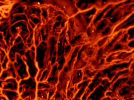 Artificial intelligence improves biomedical imaging