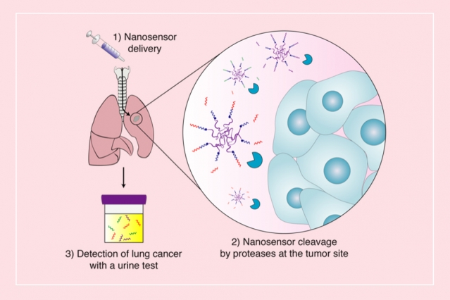 MIT engineers have developed nanoparticles that can be delivered to the lungs, where tumor-associated proteases cut peptides on the surface of the particles, releasing reporter molecules. Those reporters can be detected by a urine test. @ MIT researchers