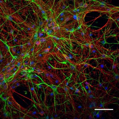 Carbon nanotubes able to take on the desired shapes thanks to a special chemical treatment, called crosslinking and, at the same time, able to function as substrata for the growth of nerve cells, finely tuning their growth and activity. @ Rossana Rauti