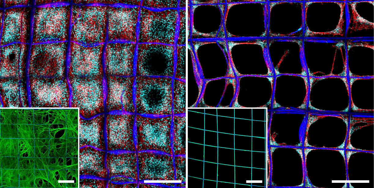 On the left, cells leverage the fibronectin network to build colonies that span whole compartments, each half a millimeter across. The inset shows how the fibronectin bridges within and between individual compartments. On the right, balled-up fibronectin is coated onto the structure in the conventional way, as shown in the inset. The cells are somewhat successful at building 3D colonies at the corners, but the interiors of the compartments are barren. @ Stacy Jordahl, Lahann Lab