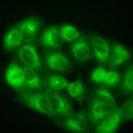 Sophia and Richard Lunt detect and attack cancer cells using technology traditionally reserved for solar power. They made dramatic improvements in light-activated fluorescent dyes for disease diagnosis, image-guided surgery and site-specific tumor treatment. @ MSU
