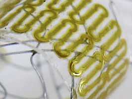 Stretchable wireless sensor could monitor healing of cerebral aneurysms