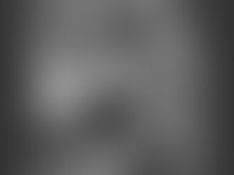 Nanodevices for the brain could thwart formation of Alzheimer's plaques