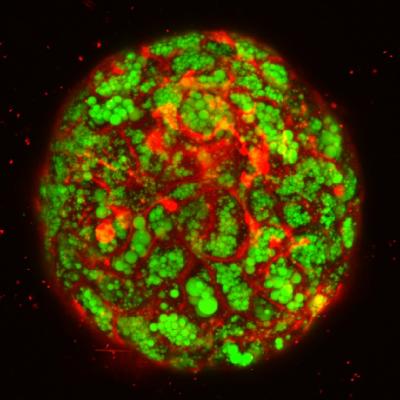 Green indicates lipid accumulation: Red visualizes cellular membrane in a single organoid @ Tokyo Institute of Research, Division of Advanced Research