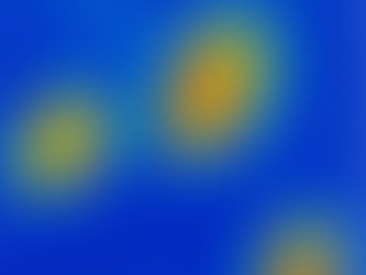 First observation of native ferroelectric metal