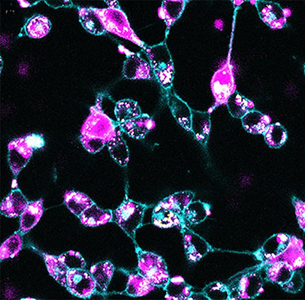 Confocal microscopy image shows fluorescent-tagged nanoparticles (pink) carrying siRNA taken up by mouse colorectal cancer cells. @ WUSTL