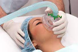 general anesthesia