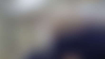 Laser odontológico: para que serve e quando é indicado