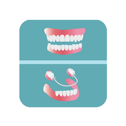 Full and partial dentures