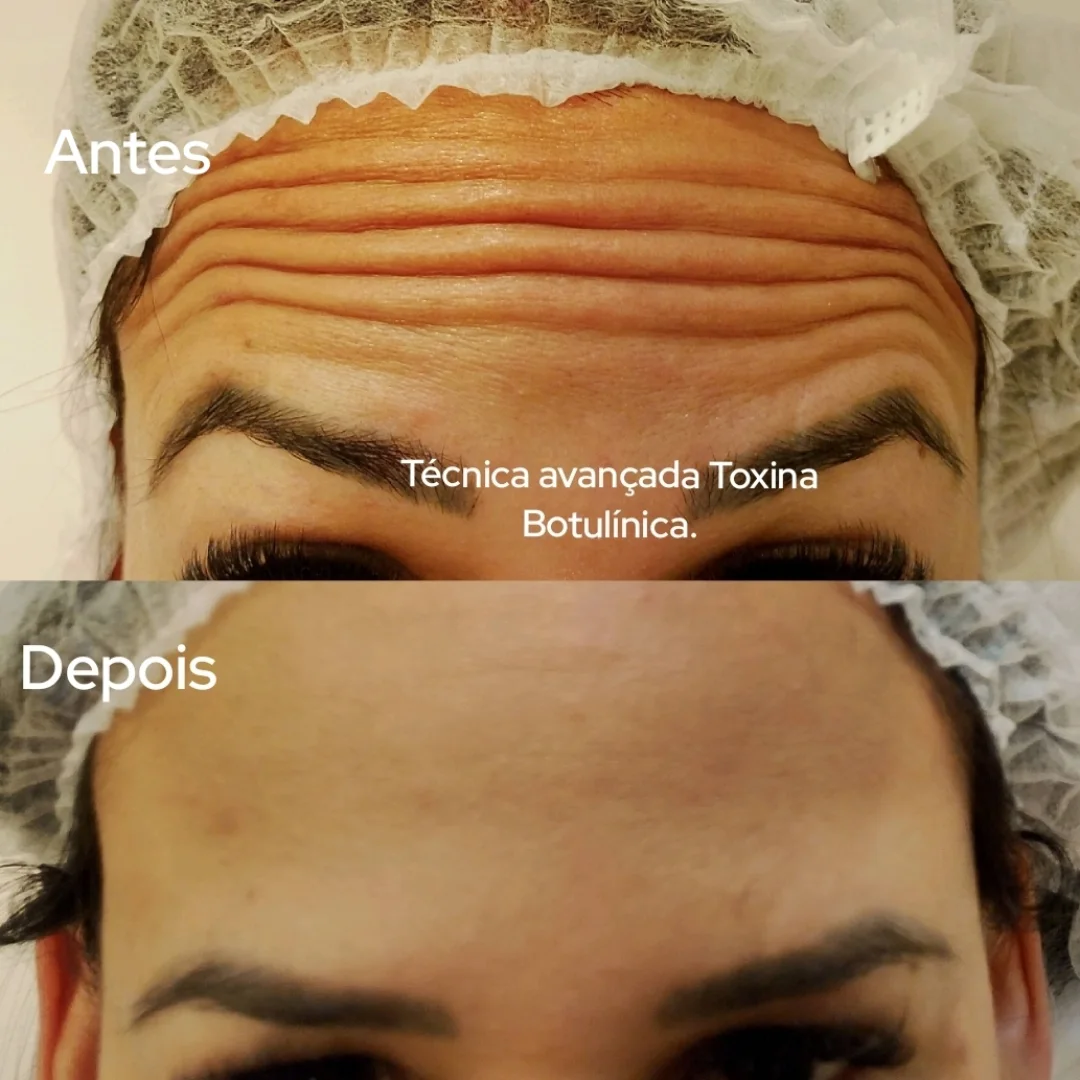 Estética facial avançada e harmonização facial com naturalidade em Rio Preto.