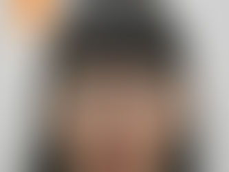 Căng da mặt - Ca LS 2